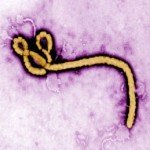 ebola disease virus image of virus under microscope